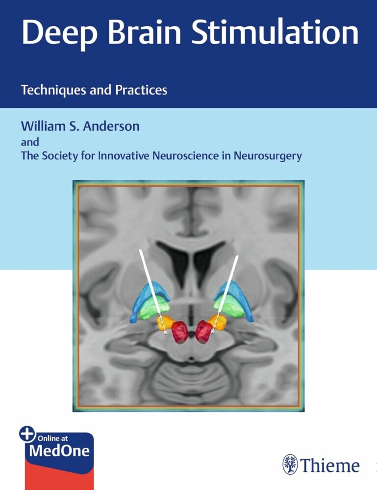Deep Brain Stimulation main product photo