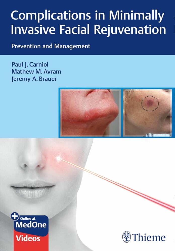Complications in Minimally Invasive Facial Rejuvenation main product photo