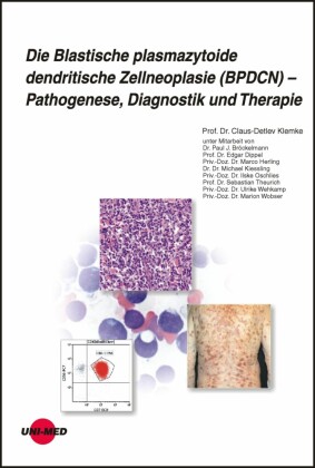 Die Blastische plasmazytoide dendritische Zellneoplasie (BPDCN) - Pathogenese, Diagnostik und Therapie