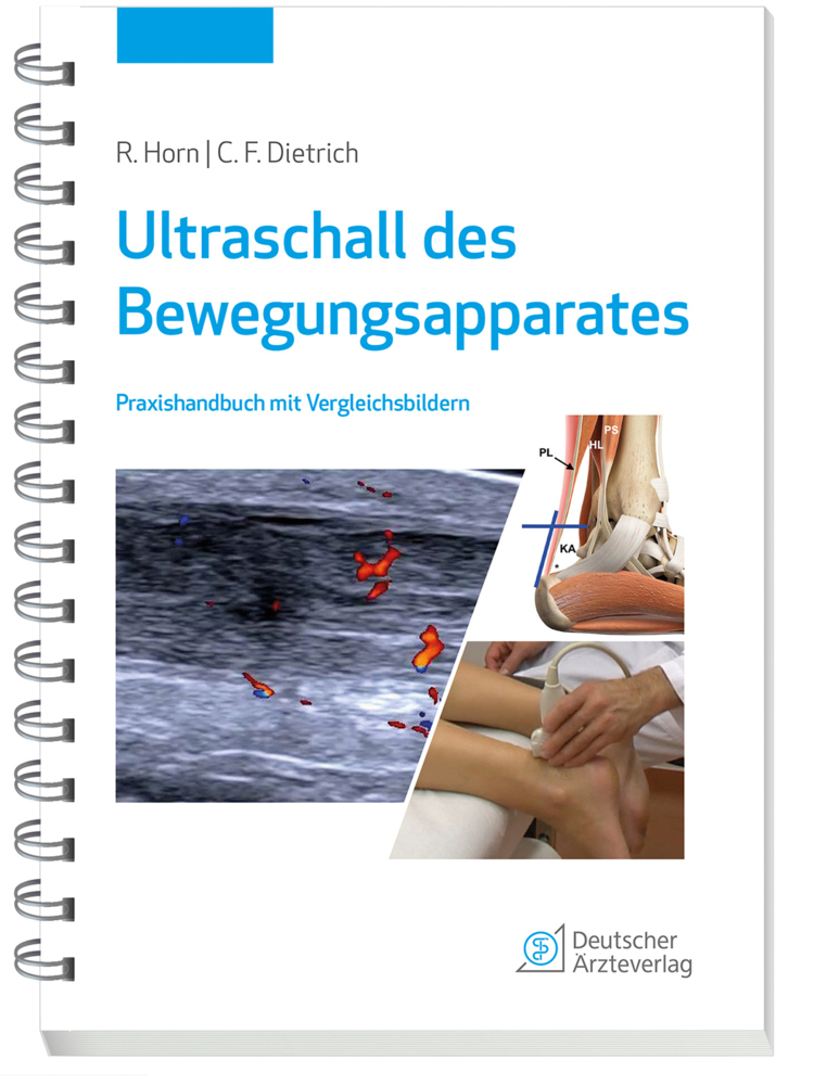 Ultraschall des Bewegungsapparates main product photo