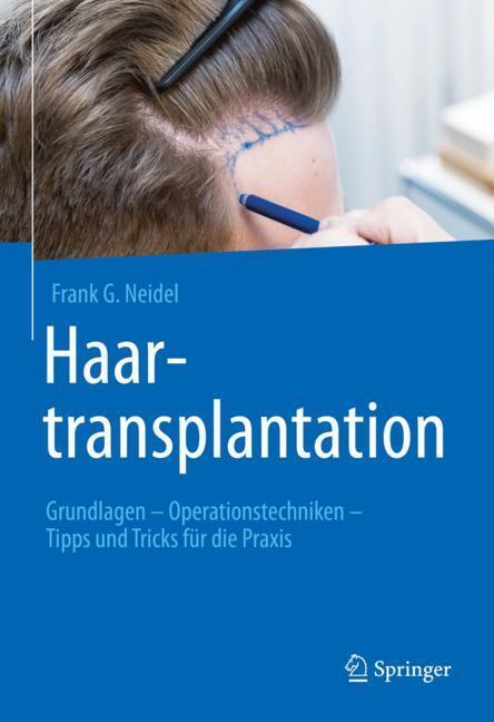 Haartransplantation main product photo