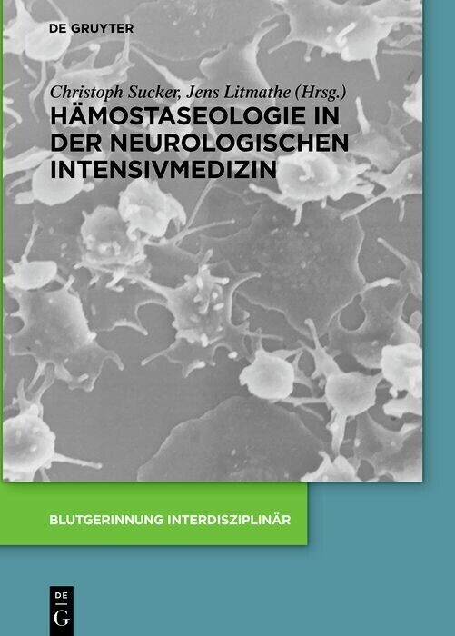 Hämostaseologie in der neurologischen Intensivmedizin main product photo