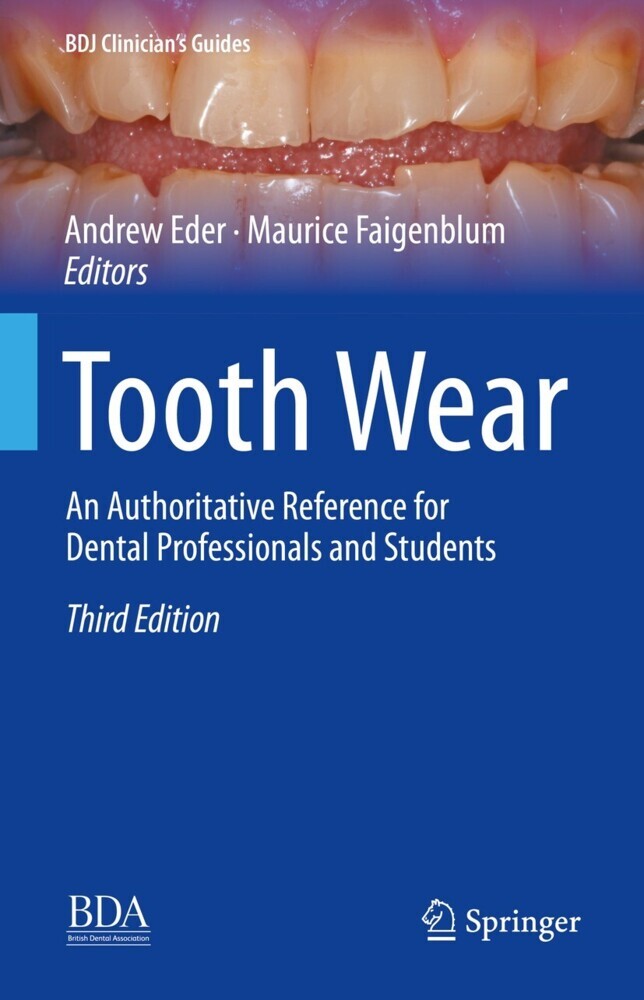 Tooth Wear main product photo