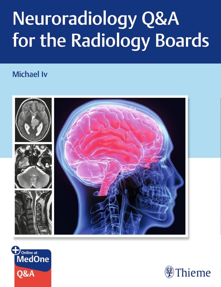 Neuroradiology Q&A for the Radiology Boards main product photo