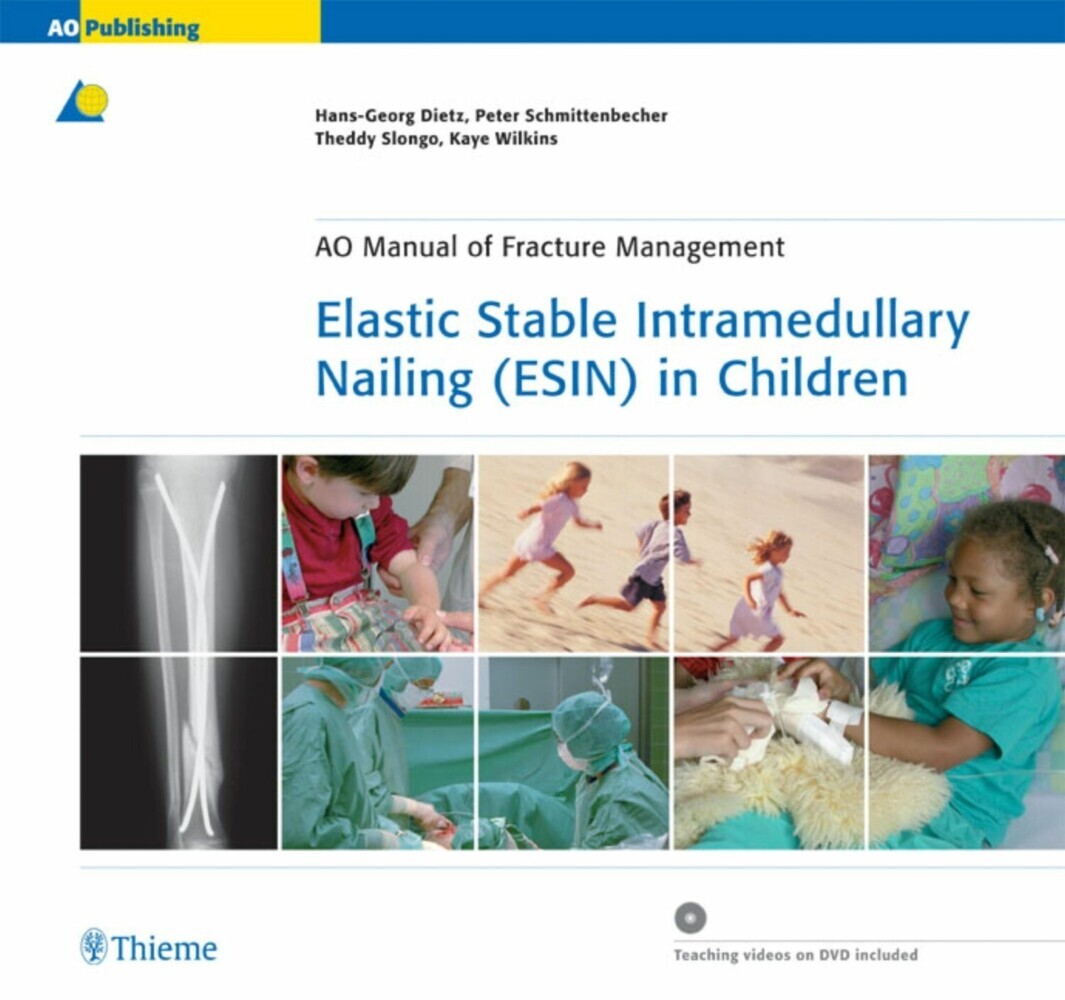 Elastic Stable Intramedullary Nailing (ESIN) in Children main product photo