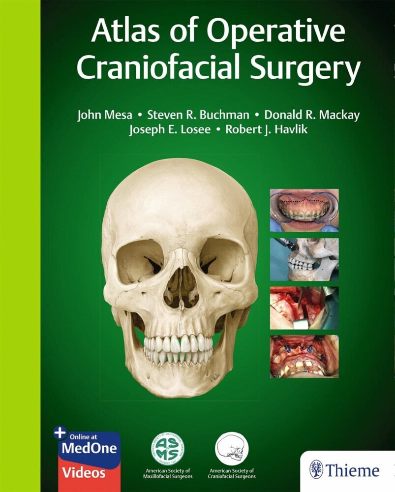 Atlas of Operative Craniofacial Surgery main product photo