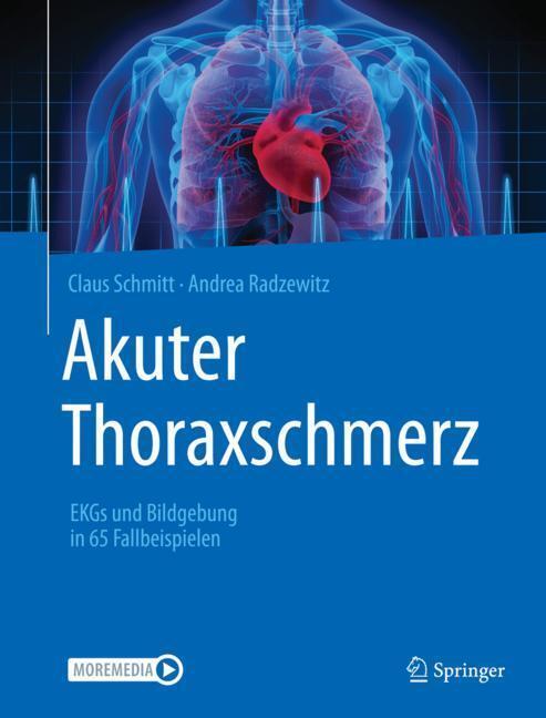 Akuter Thoraxschmerz main product photo
