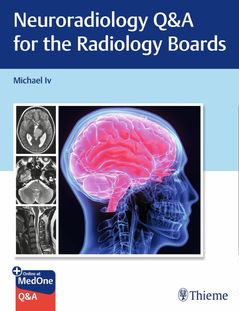 Neuroradiology Q&A for the Radiology Boards main product photo