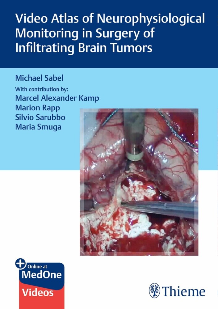 Video Atlas of Neurophysiological Monitoring in Surgery of Infiltrating Brain Tumors main product photo