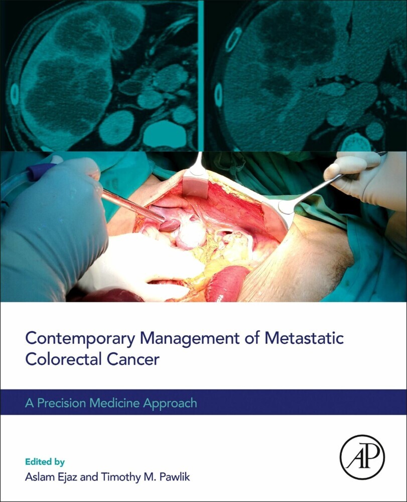 Contemporary Management of Metastatic Colorectal Cancer main product photo