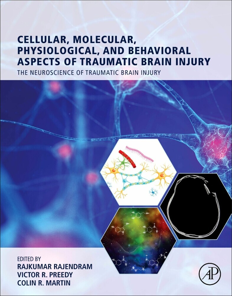 Cellular, Molecular, Physiological, and Behavioral Aspects of Traumatic Brain Injury main product photo