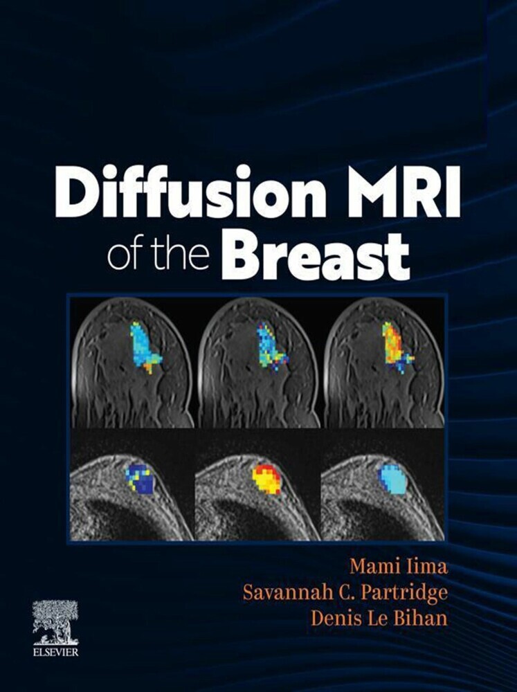 DIFFUSION MRI OF THE BREAST, E-Book main product photo