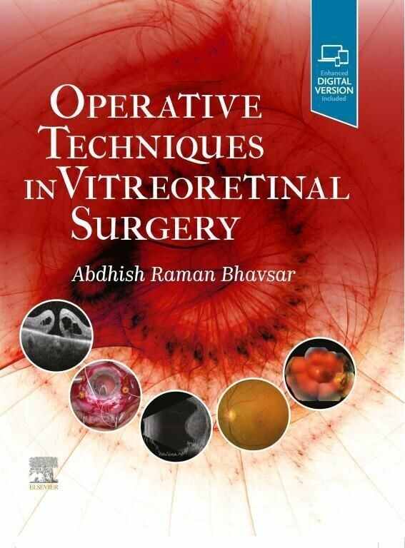 Operative Techniques in Vitreoretinal Surgery E-Book main product photo