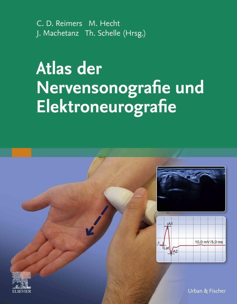 Atlas der Nervensonografie und Elektroneurografie main product photo