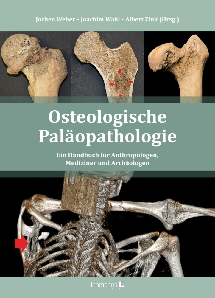 Osteologische Paläopathologie main product photo