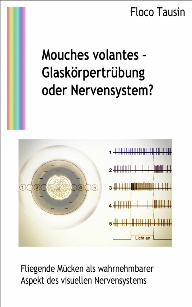 Mouches volantes - Glaskörpertrübung oder Nervensystem? main product photo