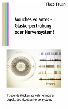 Mouches volantes - Glaskörpertrübung oder Nervensystem?