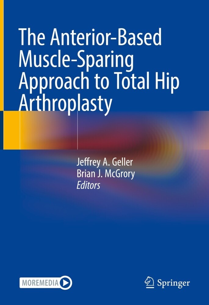 The Anterior-Based Muscle-Sparing Approach to Total Hip Arthroplasty main product photo