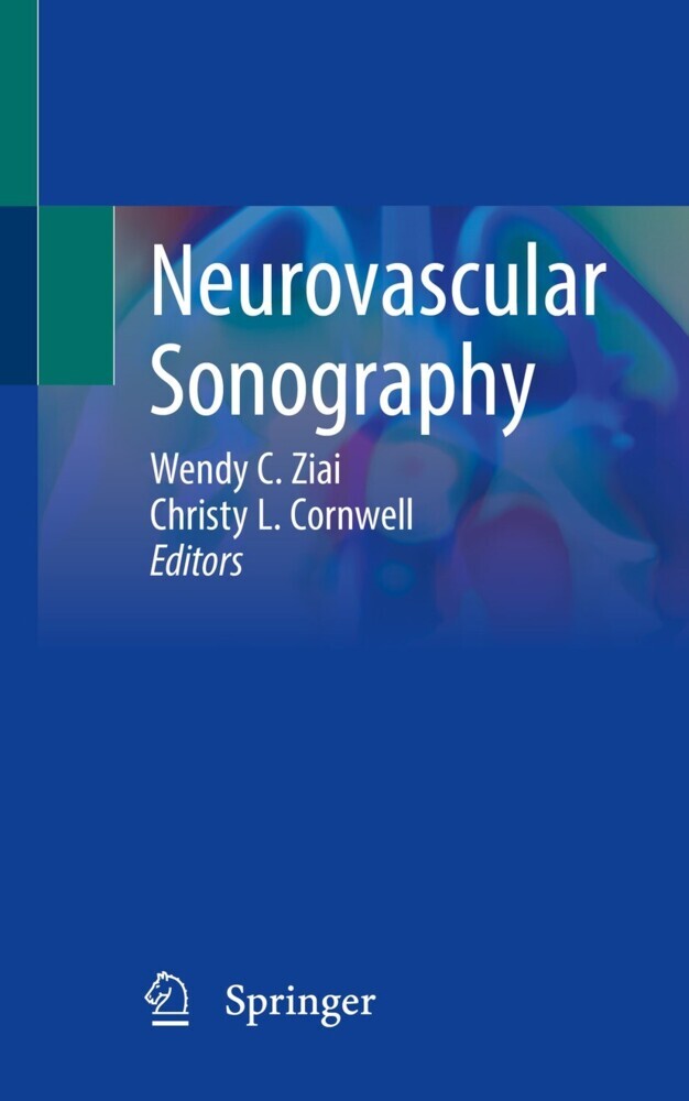 Neurovascular Sonography main product photo
