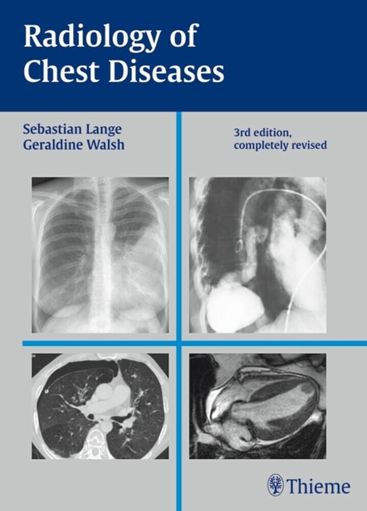 Radiology of Chest Diseases main product photo