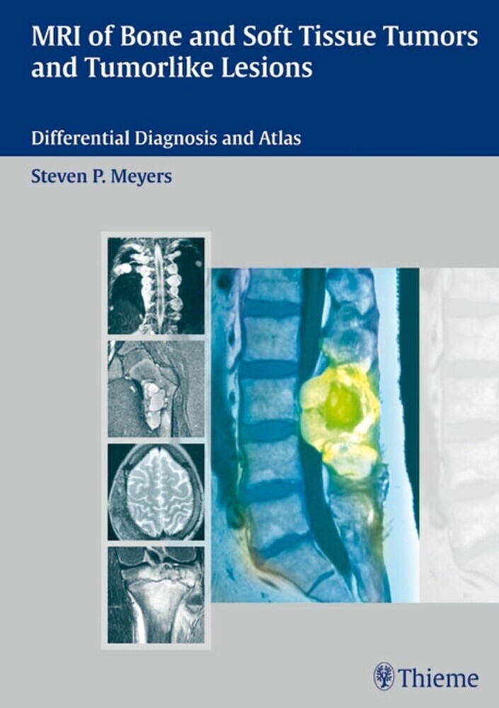 MRI of Bone and Soft Tissue Tumors and Tumorlike Lesions main product photo