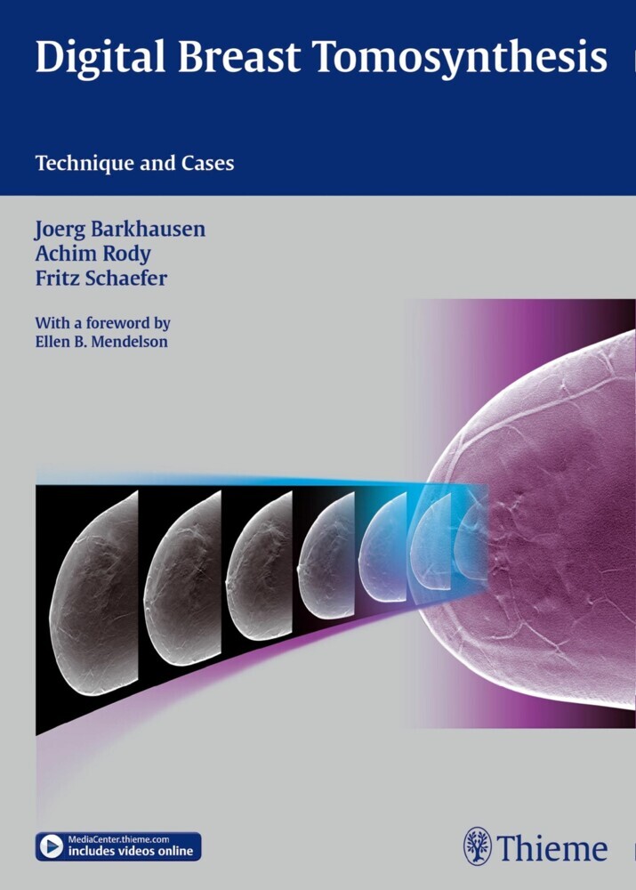 Digital Breast Tomosynthesis main product photo