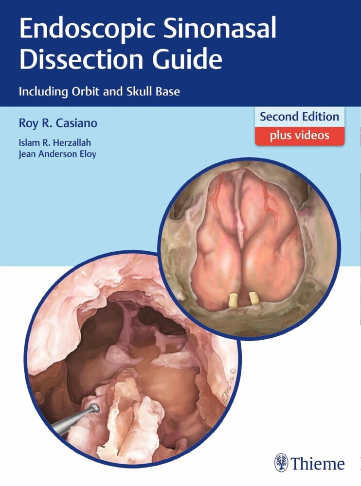 Endoscopic Sinonasal Dissection Guide main product photo