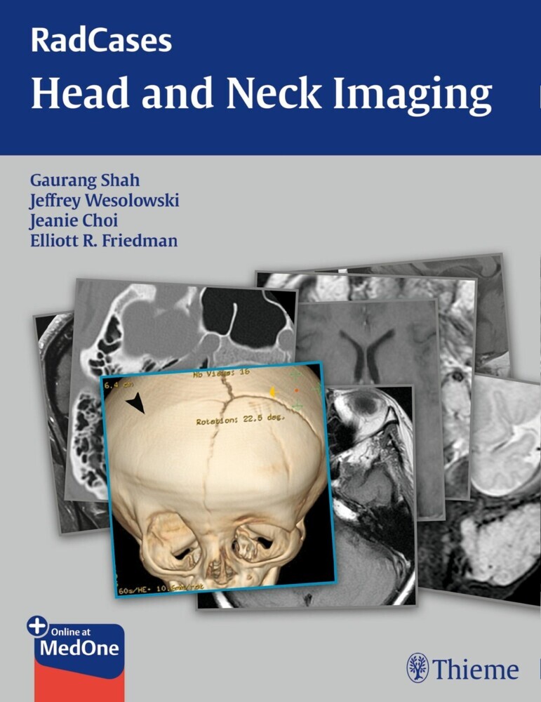 RadCases Head and Neck Imaging main product photo