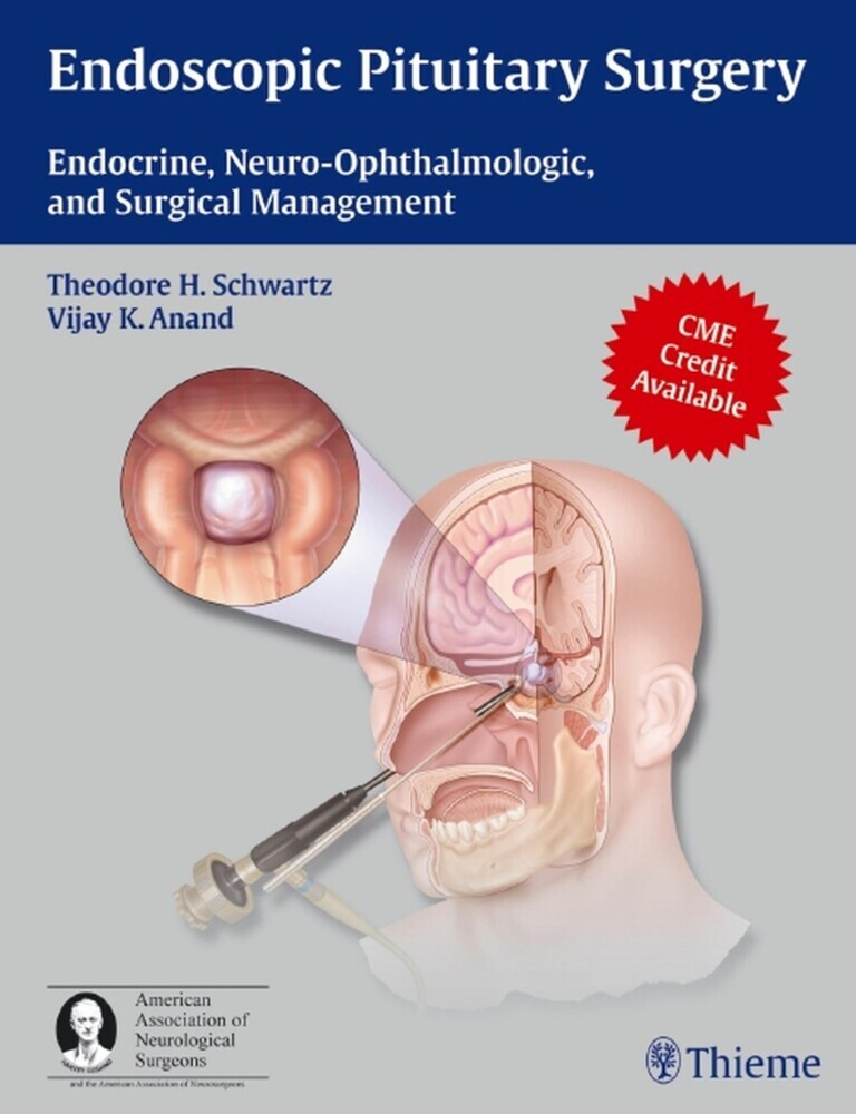 Endoscopic Pituitary Surgery main product photo