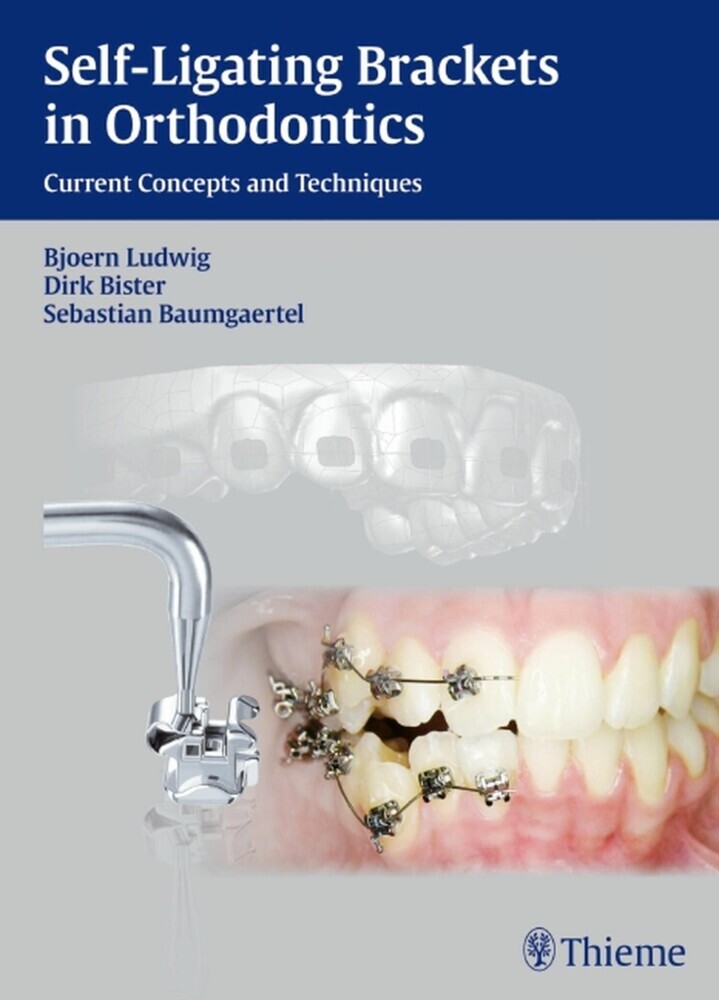 Self-Ligating Brackets in Orthodontics main product photo