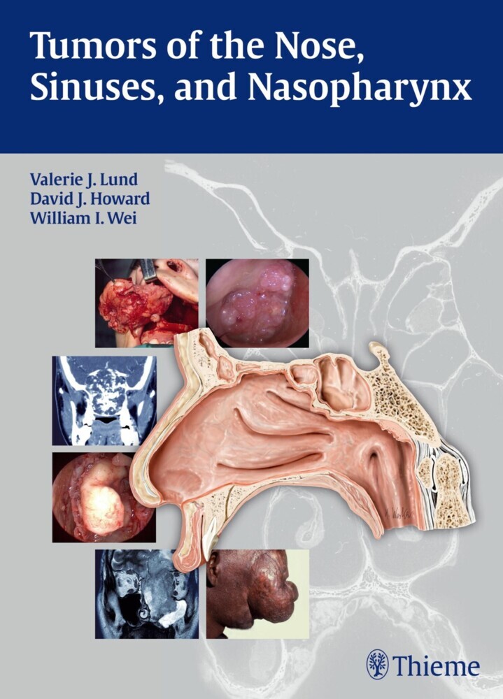 Tumors of the Nose, Sinuses and Nasopharynx main product photo