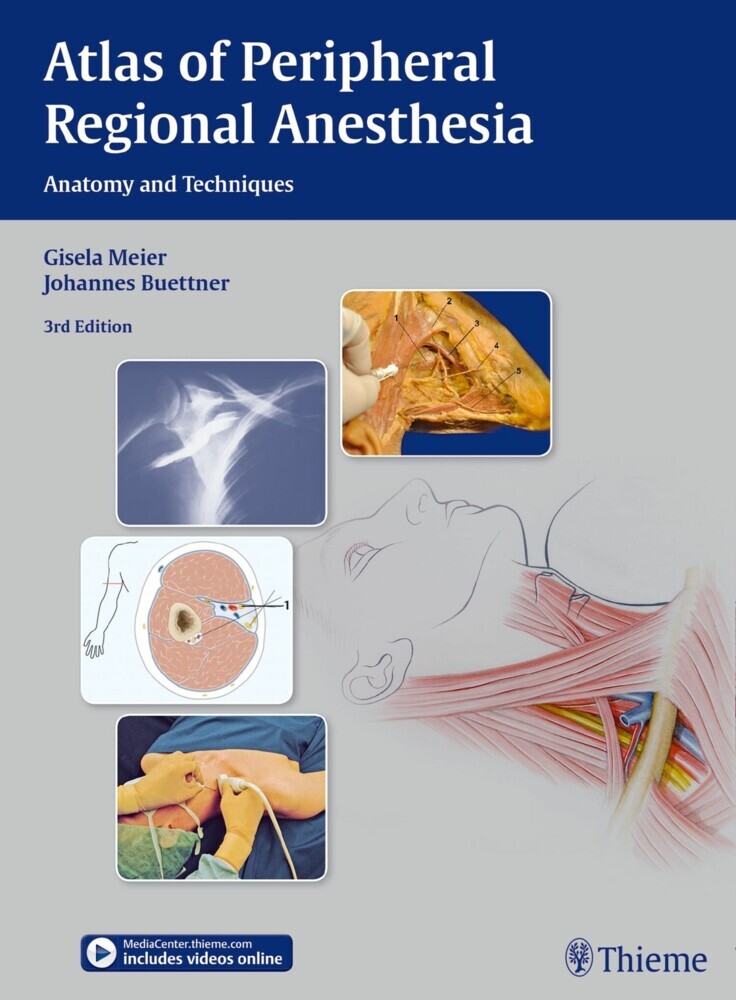 Atlas of Peripheral Regional Anesthesia main product photo