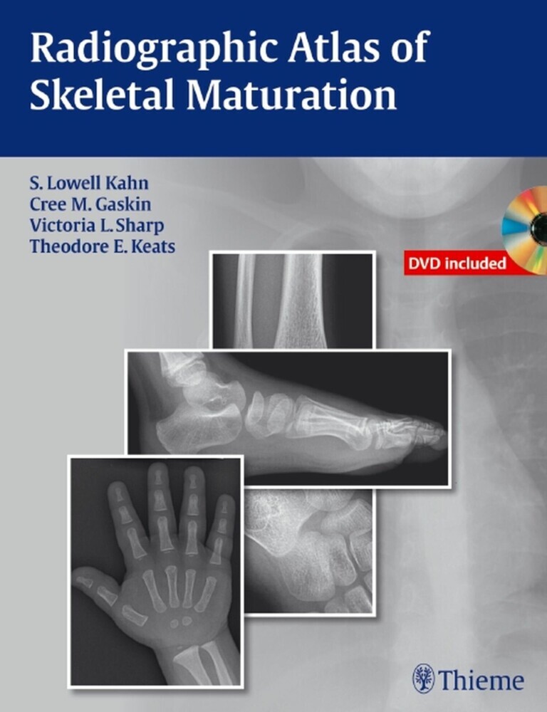 Radiographic Atlas of Skeletal Maturation main product photo