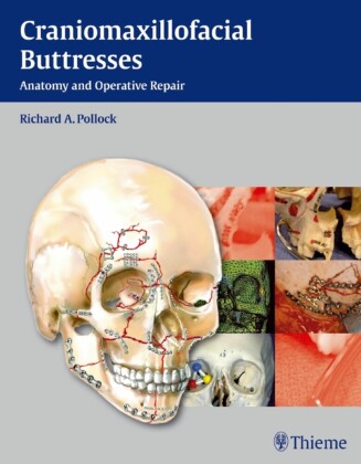 Craniomaxillofacial Buttresses