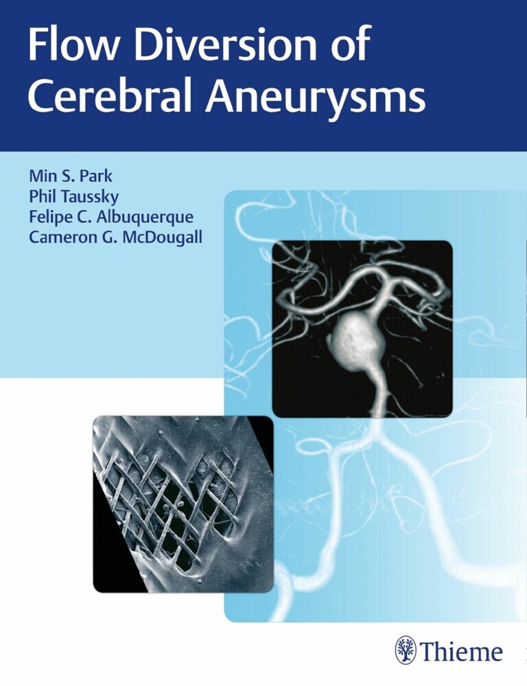 Flow Diversion of Cerebral Aneurysms main product photo