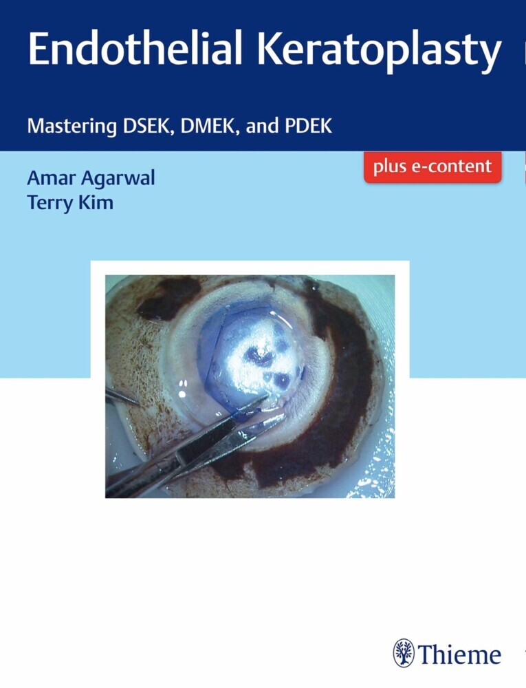 Endothelial Keratoplasty main product photo
