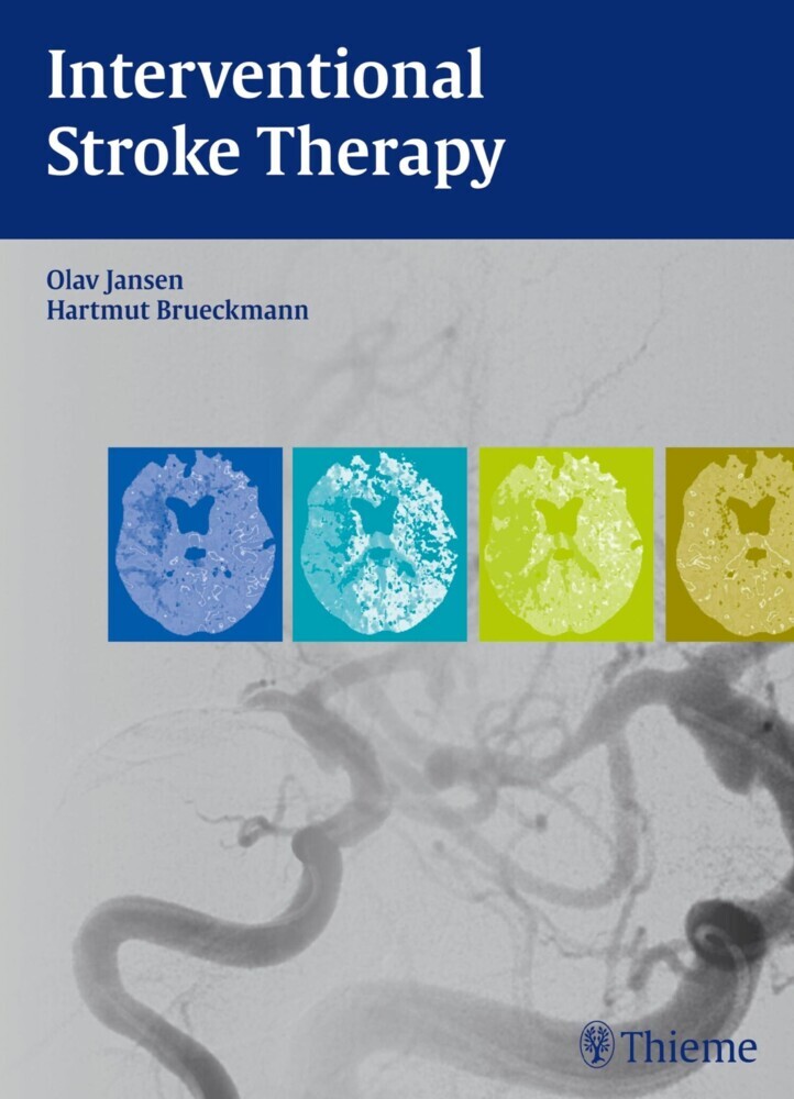 Interventional Stroke Therapy main product photo