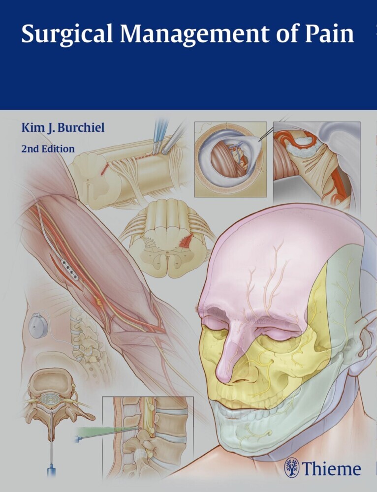 Surgical Management of Pain main product photo