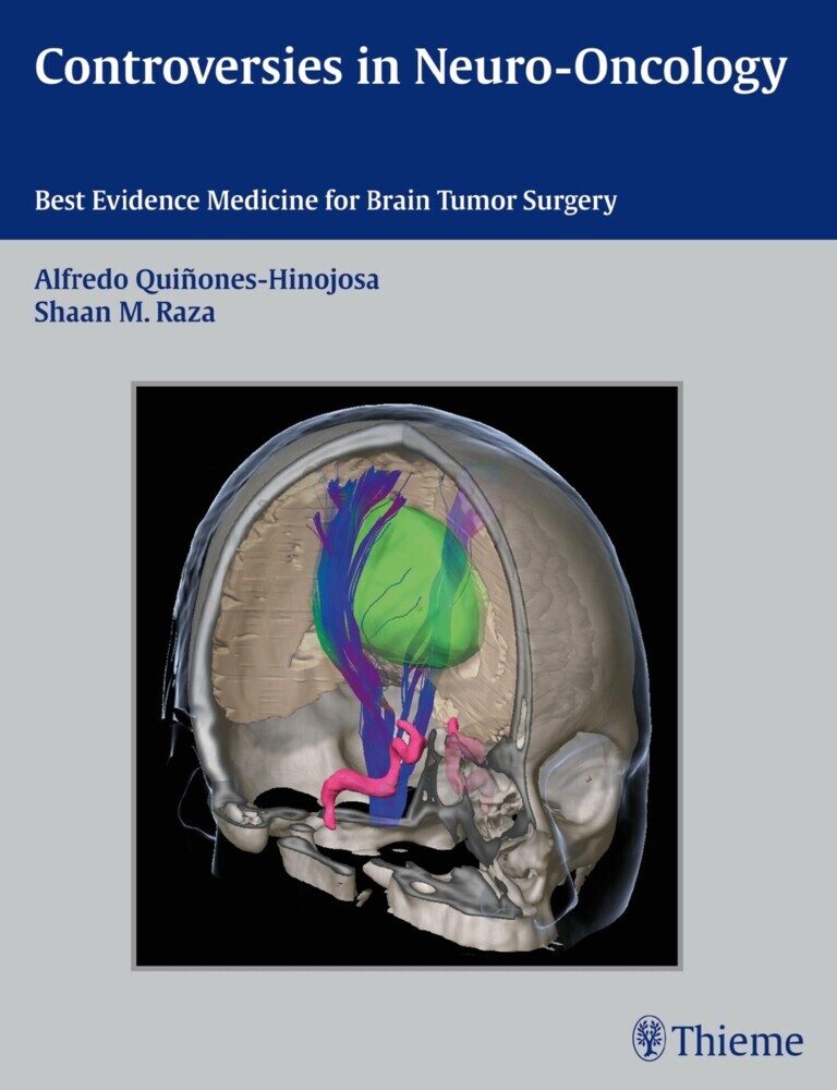 Controversies in Neuro-Oncology main product photo