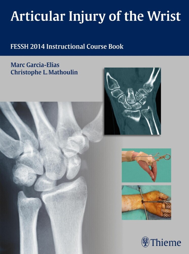 Articular Injury of the Wrist main product photo