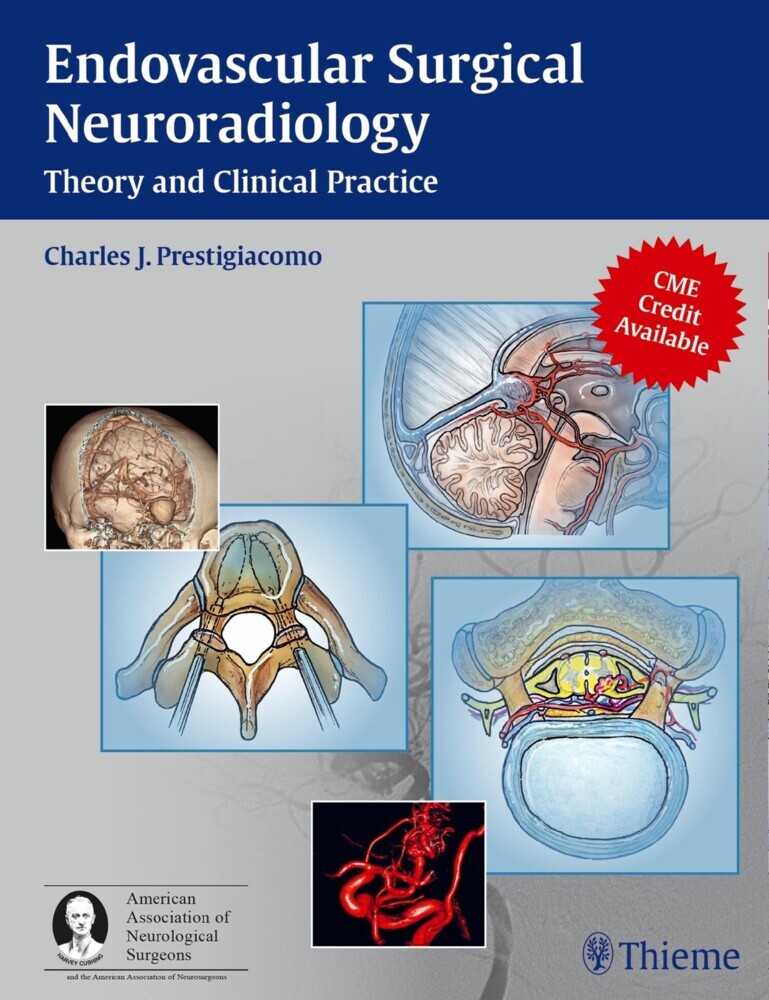 Endovascular Surgical Neuroradiology main product photo