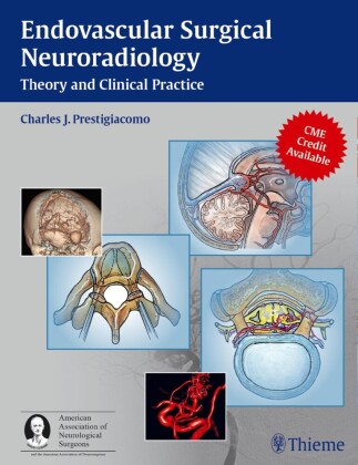 Endovascular Surgical Neuroradiology