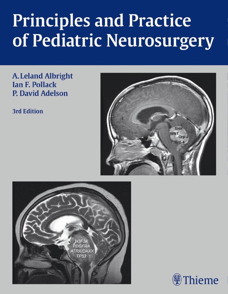 Principles and Practice of Pediatric Neurosurgery main product photo