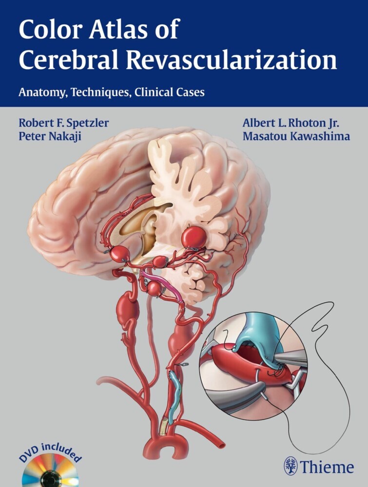 Color Atlas of Cerebral Revascularization main product photo