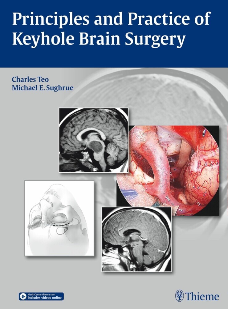 Principles and Practice of Keyhole Brain Surgery main product photo