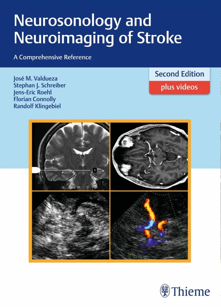Neurosonology and Neuroimaging of Stroke main product photo
