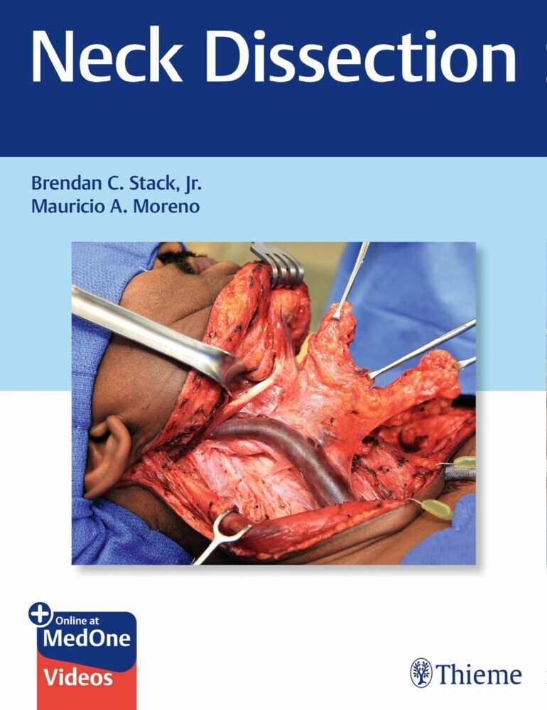 Neck Dissection main product photo