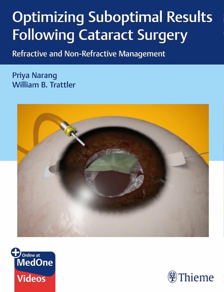Optimizing Suboptimal Results Following Cataract Surgery main product photo