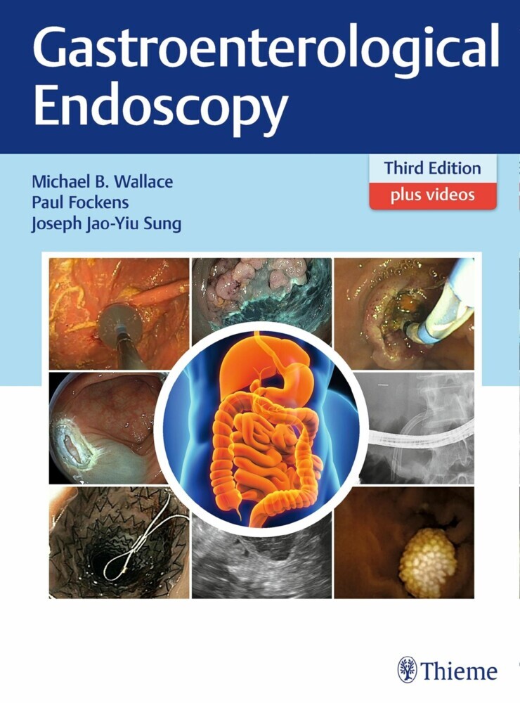 Gastroenterological Endoscopy main product photo