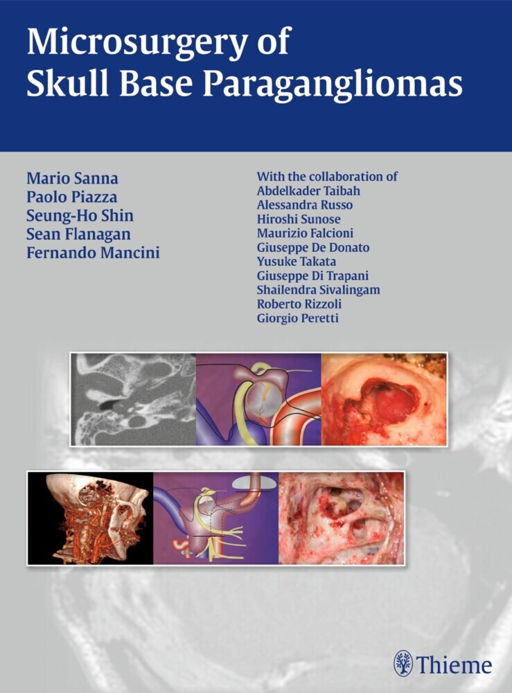 Microsurgery of Skull Base Paragangliomas main product photo